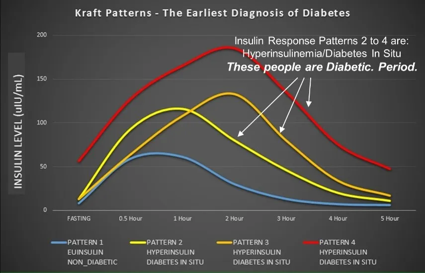 Kraft patterns - the earliest diagnosis of diabetes