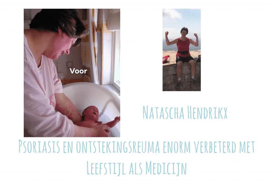 Natascha Hendrikx Psioriasis en Ontstekingsreuma