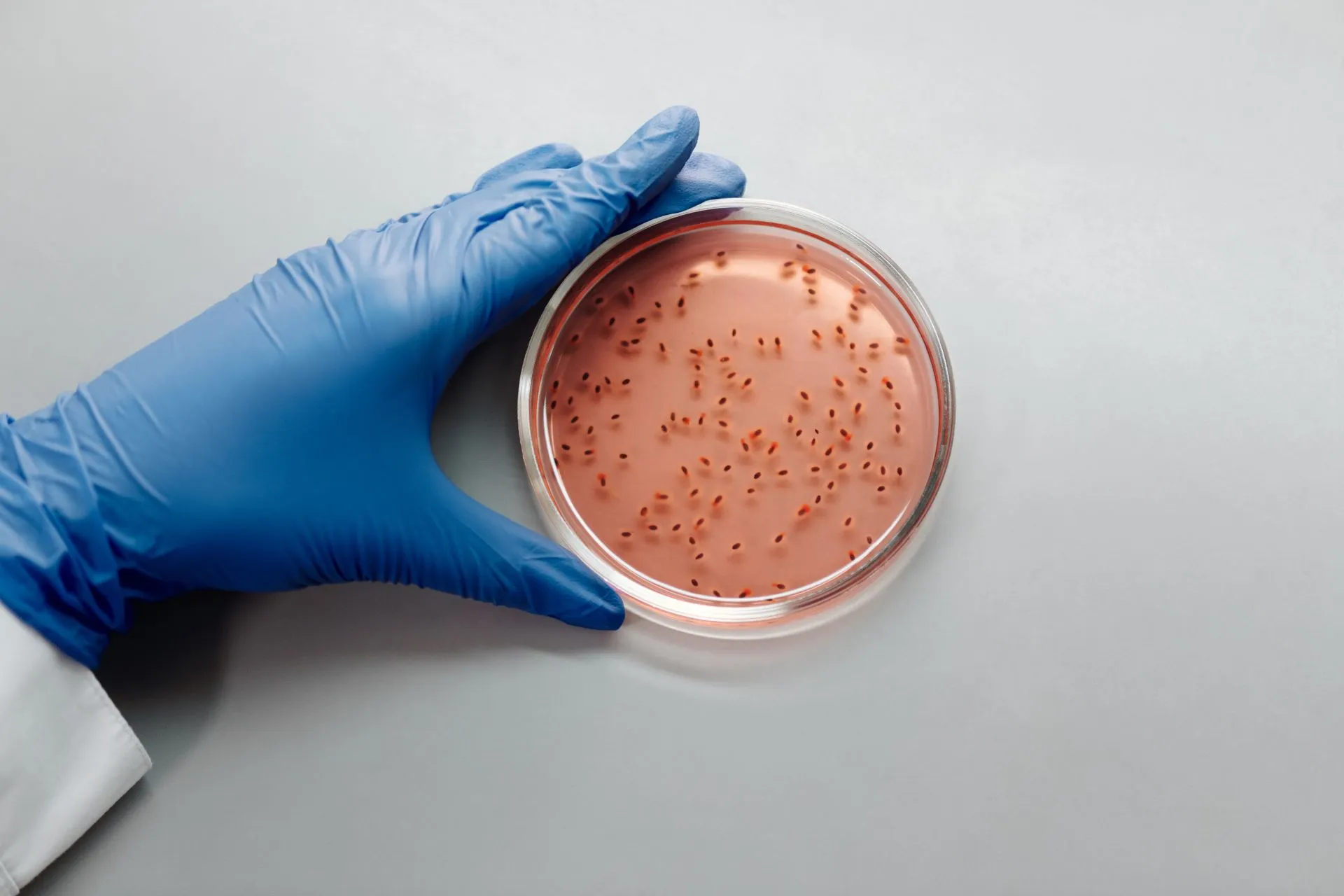 Wetenschapper met blauwe handschoenen bekijkt een bacteriekweek in een petrischaal.